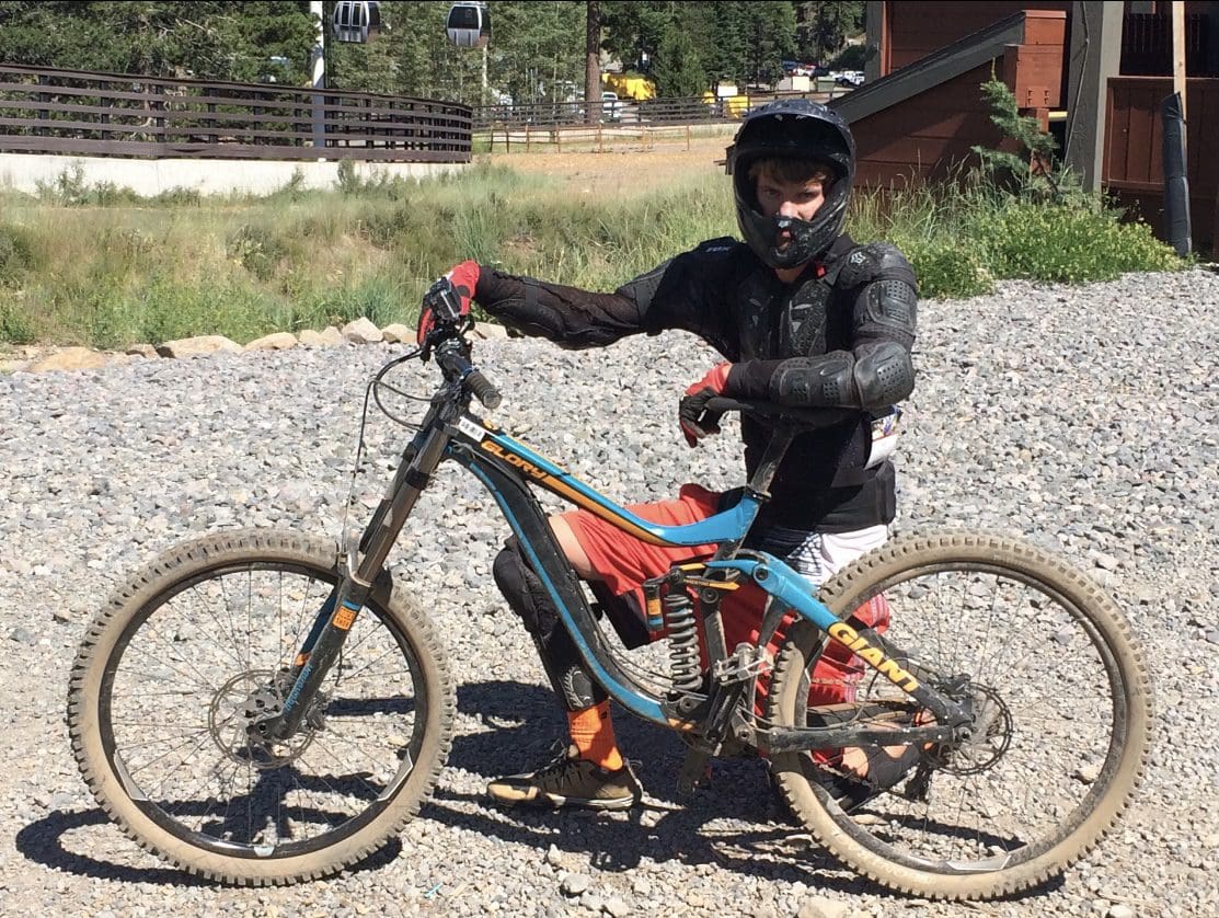 A man with Klinefelter syndrome standing by his downhill bike
